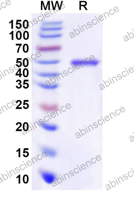 Human TLX1 Recombinant Protein (N-His-KSI)