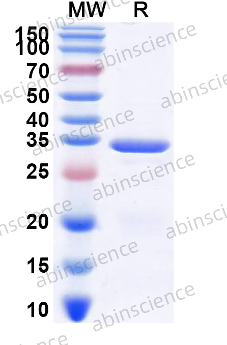 Human ABCD1 Recombinant Protein (N-His)