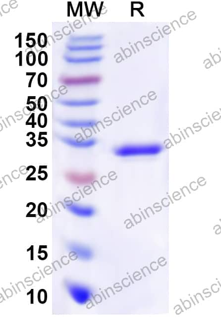 Human PTPN4 Recombinant Protein (N-His)