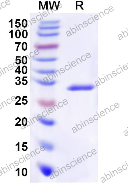 Human IMPA1 Recombinant Protein (N-His)