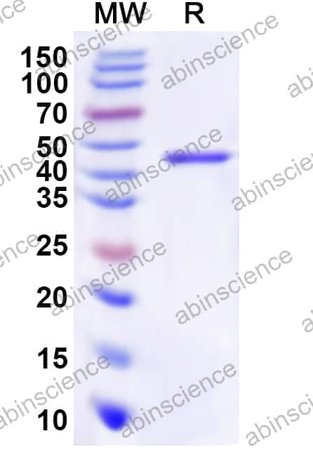 Human RAP1GAP Recombinant Protein (N-His)