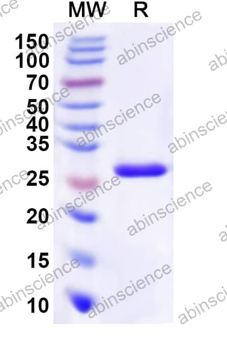 Human HTR2B Recombinant Protein (N-His-KSI)