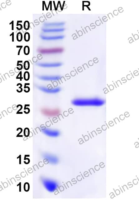 Human BRCC3 Recombinant Protein (N-His)