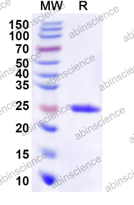 Human GPR4 Recombinant Protein (N-His-KSI)