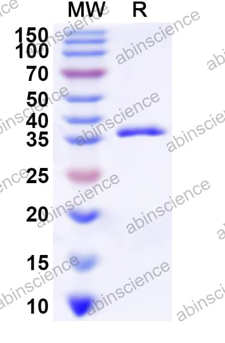 Human SLC1A6 Recombinant Protein (N-GST & C-His)