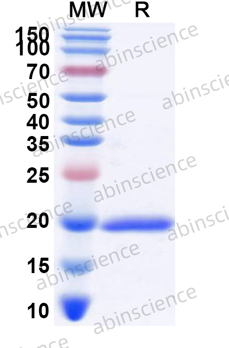 Human LHX1 Recombinant Protein (N-His)