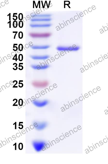 Human PPM1F Recombinant Protein (N-His)
