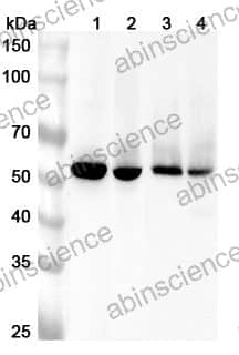 Anti-Human PPM1F Polyclonal Antibody