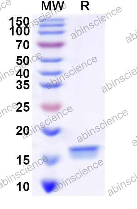 Human MSX2 Recombinant Protein (N-His)