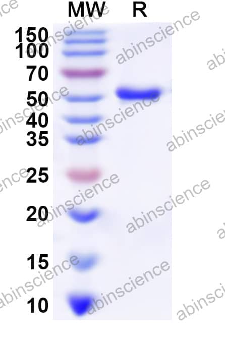 Human IGFALS Recombinant Protein (N-His)