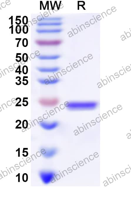 Human TRIM23 Recombinant Protein (N-His)