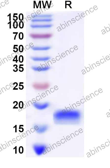 Human POLR2I Recombinant Protein (C-His)