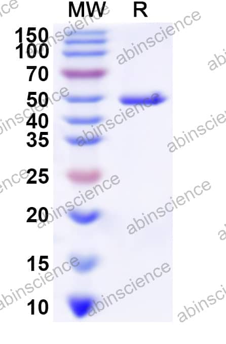 Human FNTB Recombinant Protein (N-His)