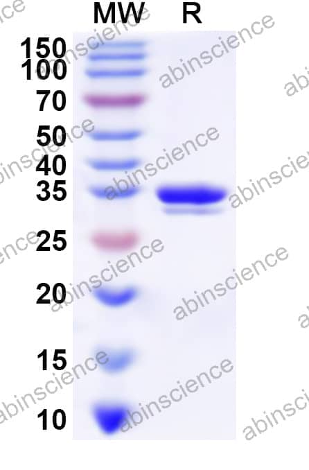 Human PRIM2 Recombinant Protein (N-His)