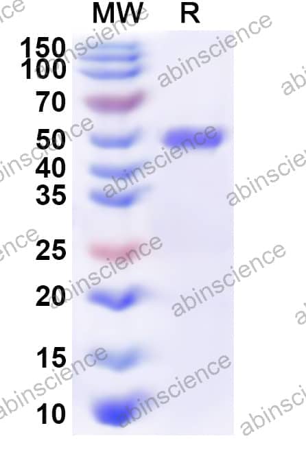 Human POLD2 Recombinant Protein (N-His)