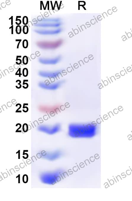 Human PCYT1A Recombinant Protein (N-His)