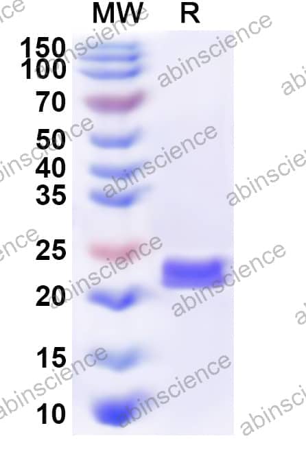 Human ARL4D Recombinant Protein (N-His)
