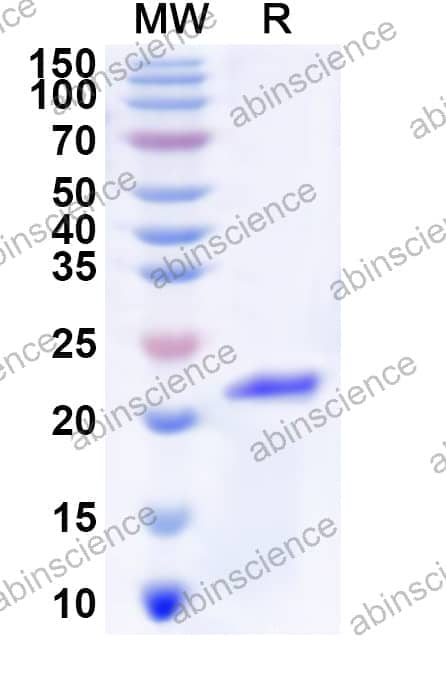 Human MTNR1A Recombinant Protein (N-His-KSI)