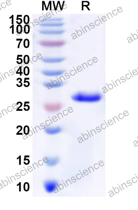 Human MTHFS Recombinant Protein (N-His)