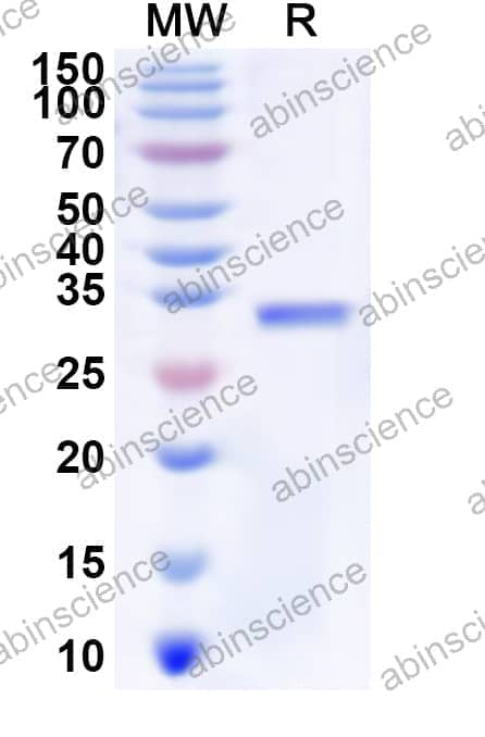 Human NPY4R Recombinant Protein (N-GST & C-His)