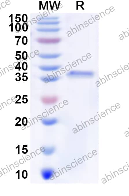 Human PDLIM4 Recombinant Protein (N-GST & C-His)