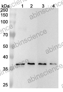 Anti-PDLIM4 Polyclonal Antibody