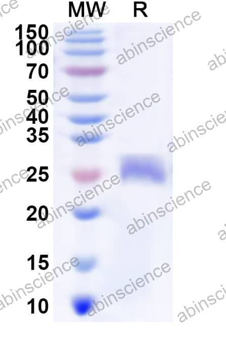 Human ZNF3 Recombinant Protein (N-His)