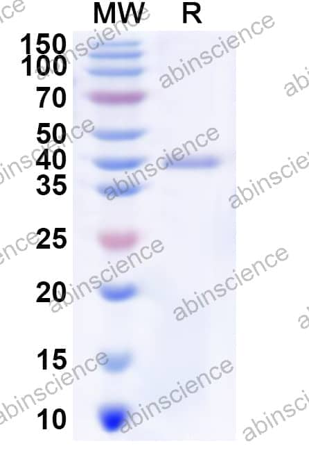 Human NUBP1 Recombinant Protein (N-His)