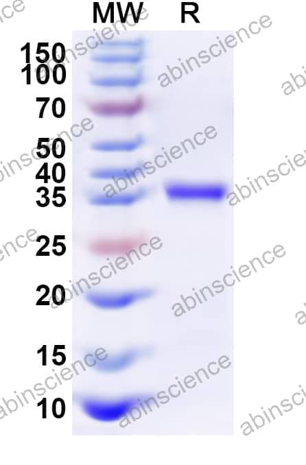 Human PTPN3 Recombinant Protein (N-His)
