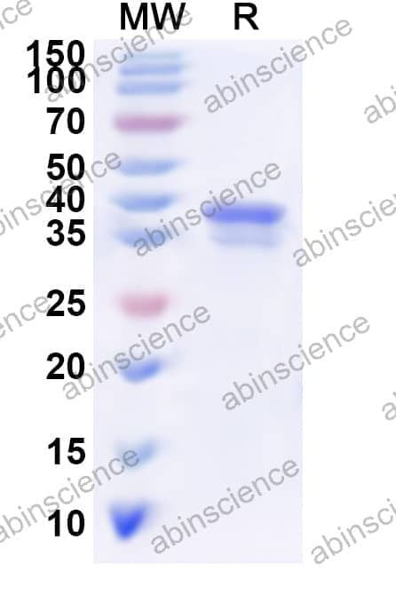 Human AKR1C2 Recombinant Protein (N-His)