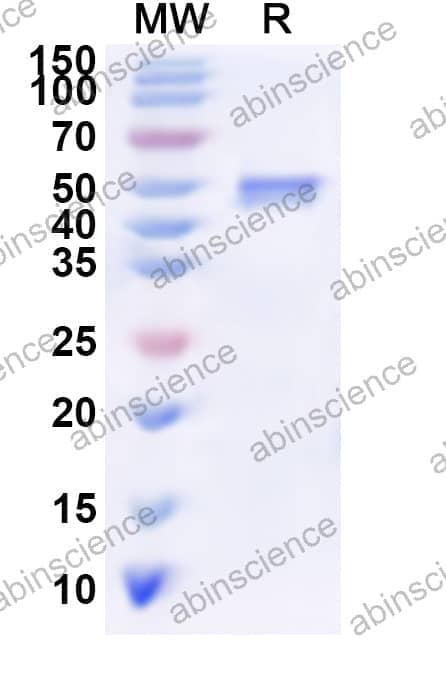 Human HMGCS2 Recombinant Protein (N-His)