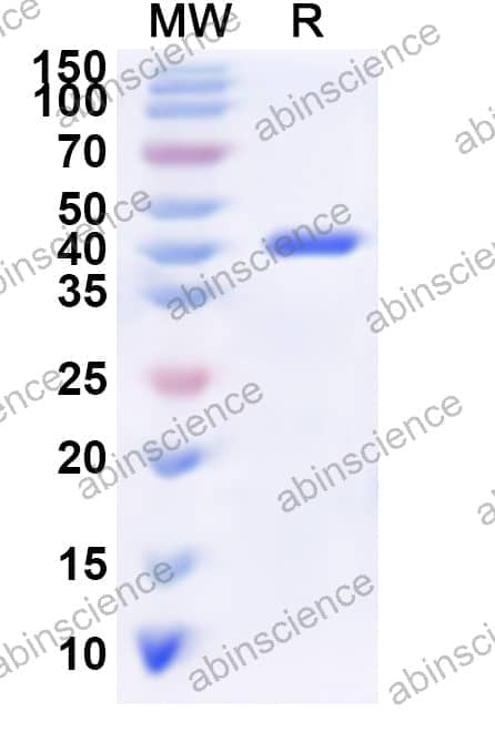 Human ADPRH Recombinant Protein (N-His)