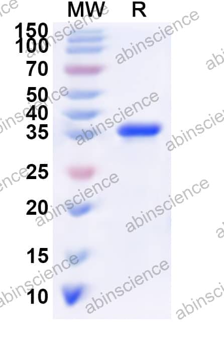 Human PER3 Recombinant Protein (N-His)