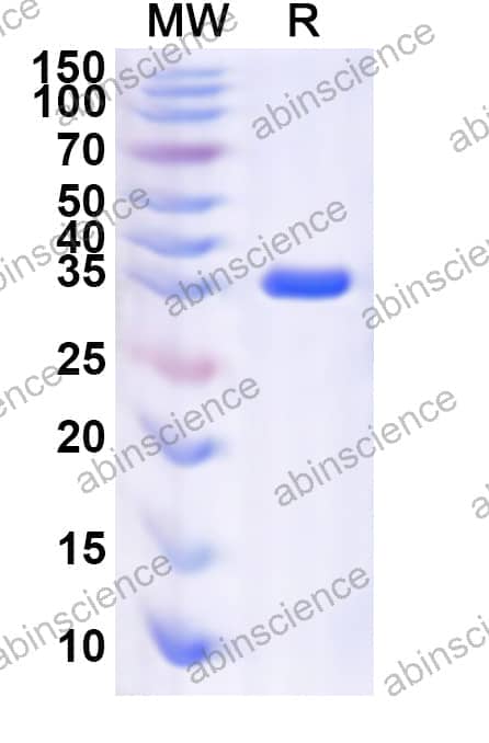 Human SCAND1 Recombinant Protein (N-GST & C-His)