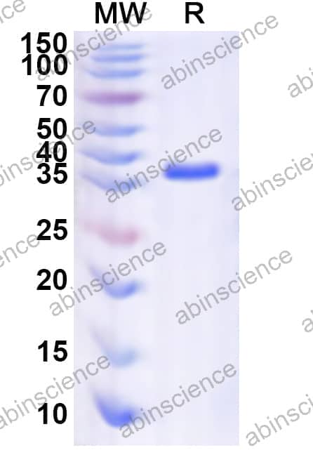 Human RPL37A Recombinant Protein (N-GST & C-His)