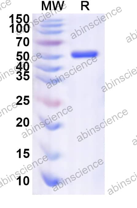 Human ZNF24 Recombinant Protein (N-His)