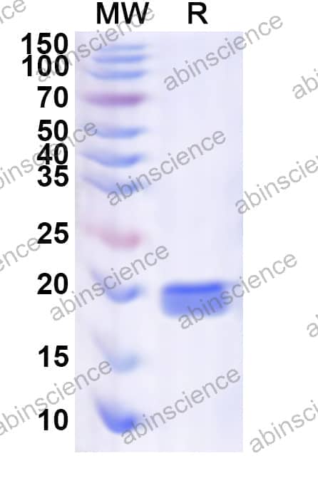 Human NCBP2 Recombinant Protein (N-His)