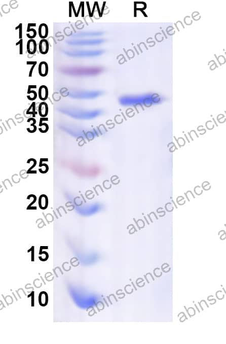 Human OTOF Recombinant Protein (N-His)