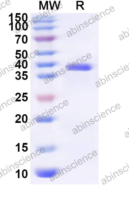 Human GTF2A1 Recombinant Protein (N-His-KSI)