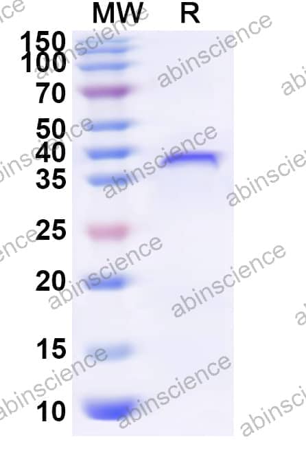 Human ZNF140 Recombinant Protein (N-His)