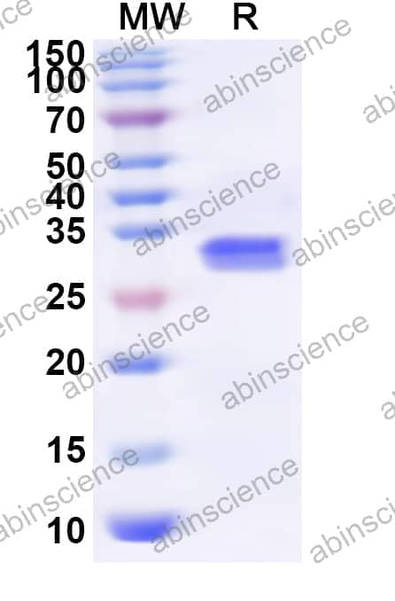 Human RBM5 Recombinant Protein (N-His)