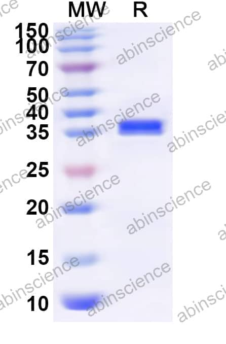 Human RBM11 Recombinant Protein (N-GST & C-His)