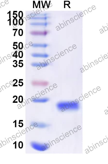 Human NANOS2 Recombinant Protein (C-His)