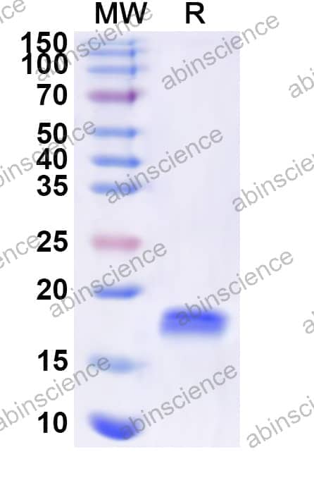 Human LMO4 Recombinant Protein (N-His)