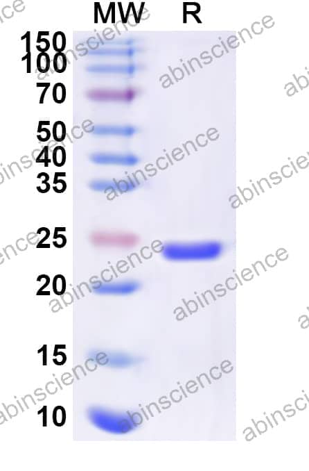 Human POLR2G Recombinant Protein (N-His)
