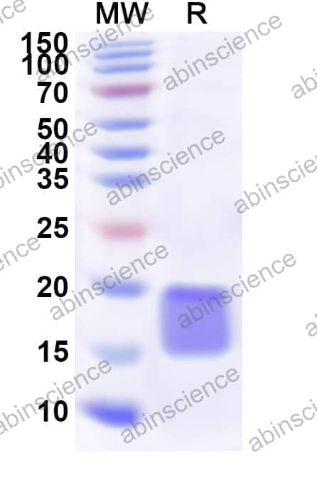 Human RPS13 Recombinant Protein (N-His)