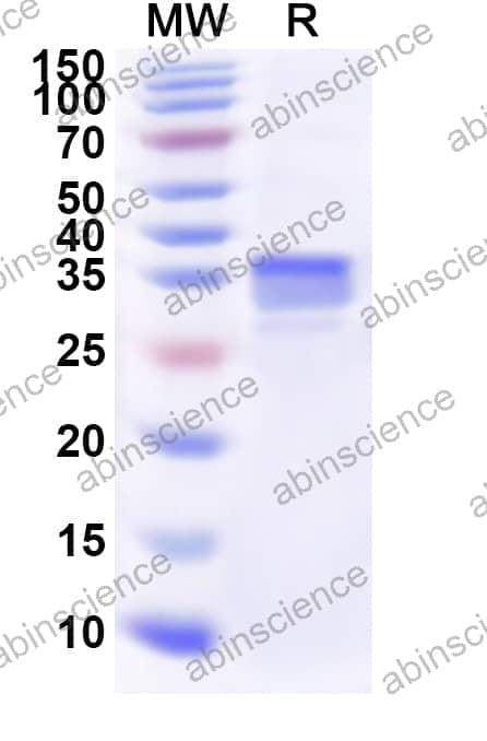 Human LSM6 Recombinant Protein (N-GST & C-His)