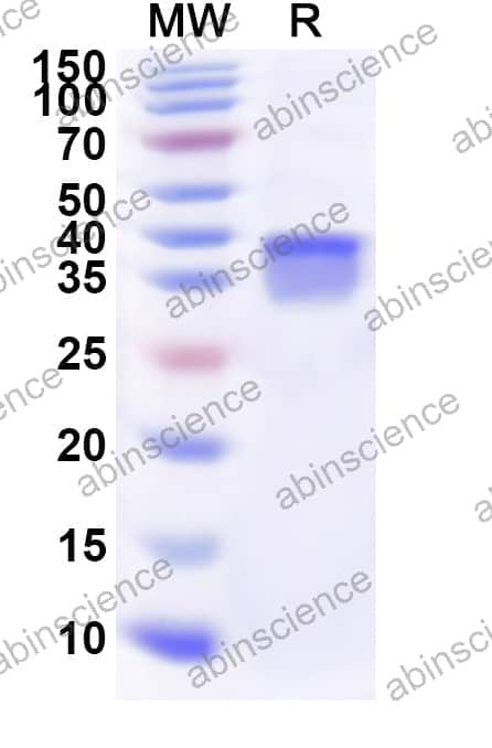 Human RPS25 Recombinant Protein (N-GST & C-His)