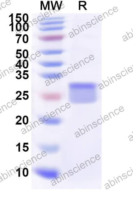 Human GNGT1 Recombinant Protein (N-His-KSI)