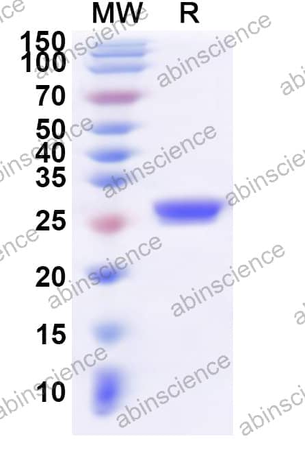 Human RPP30 Recombinant Protein (N-His)